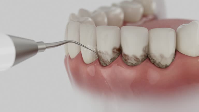 Trusted Root Canal Treatment service in Lyles, TN - Dentist Open Now